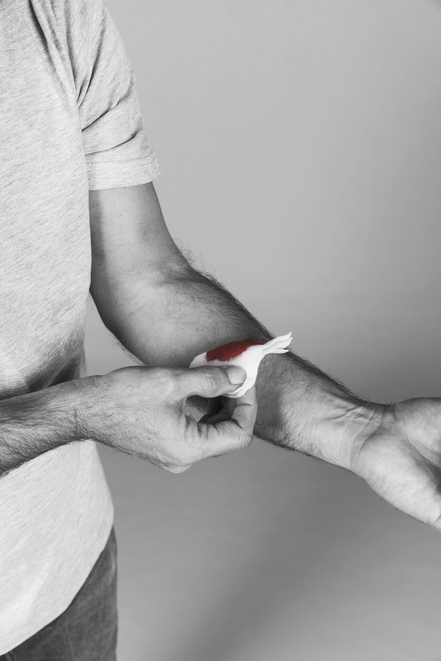 piqûre de guêpe dard dans la peau piqûre de guêpe dard dans la peau