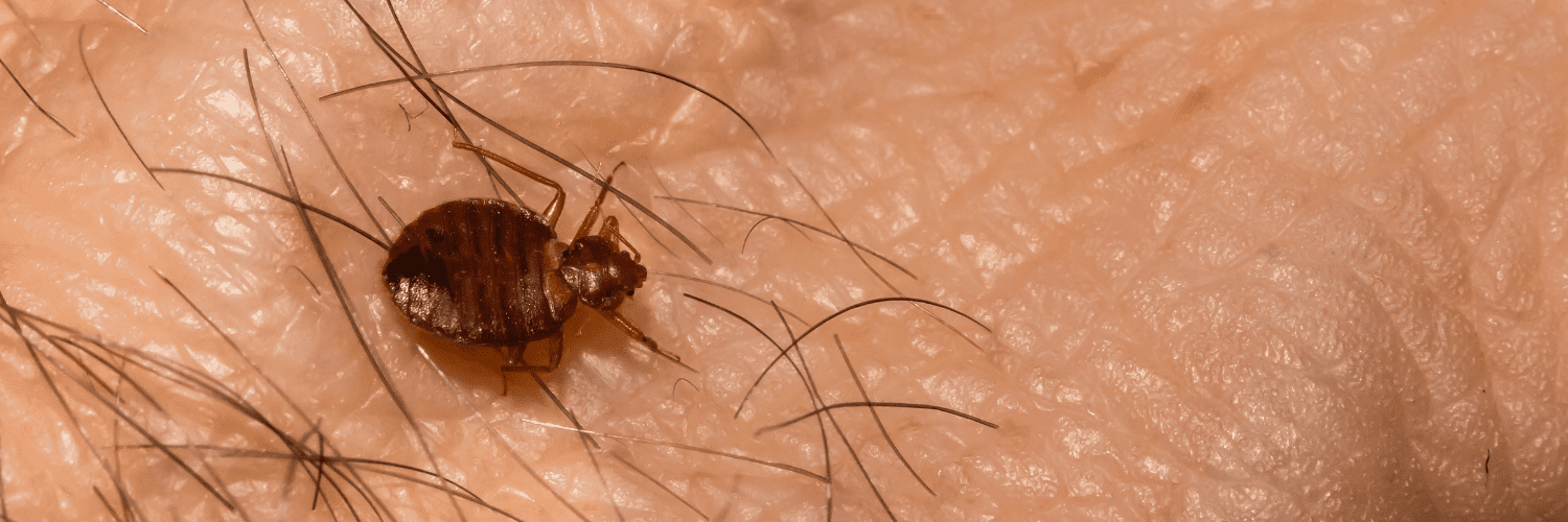 punaise de lit sur de la peau
